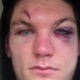Illustration for article titled This Is What A Hockey Player Looks Like After Breaking His Face In A Fight
